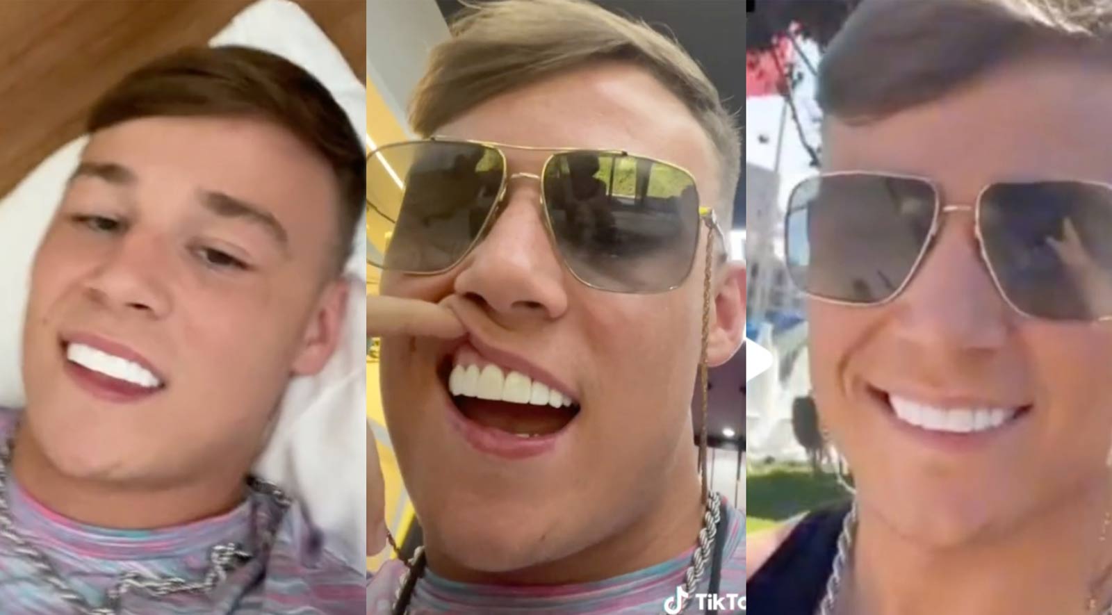 Young man showing his badly made "Turkey Teeth"
