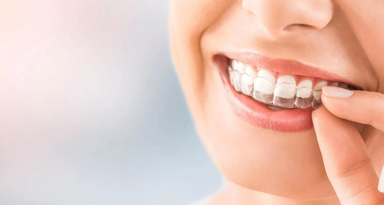 Magic Teeth Braces