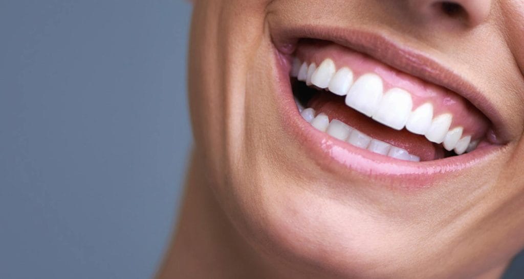 Smile Makeover Antalya