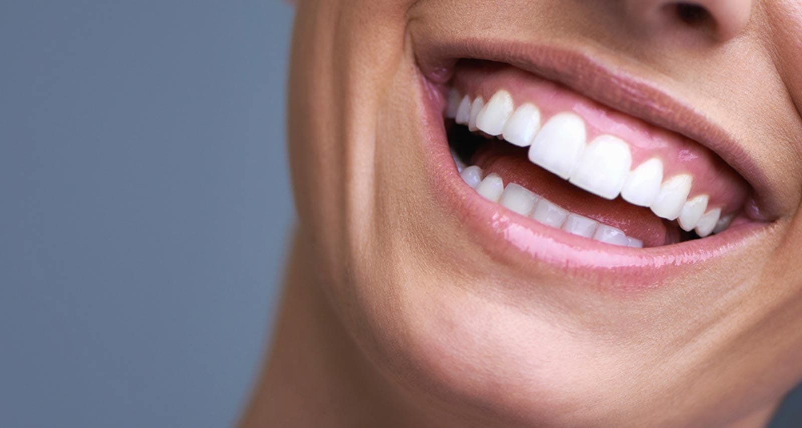 Smile Makeover Antalya