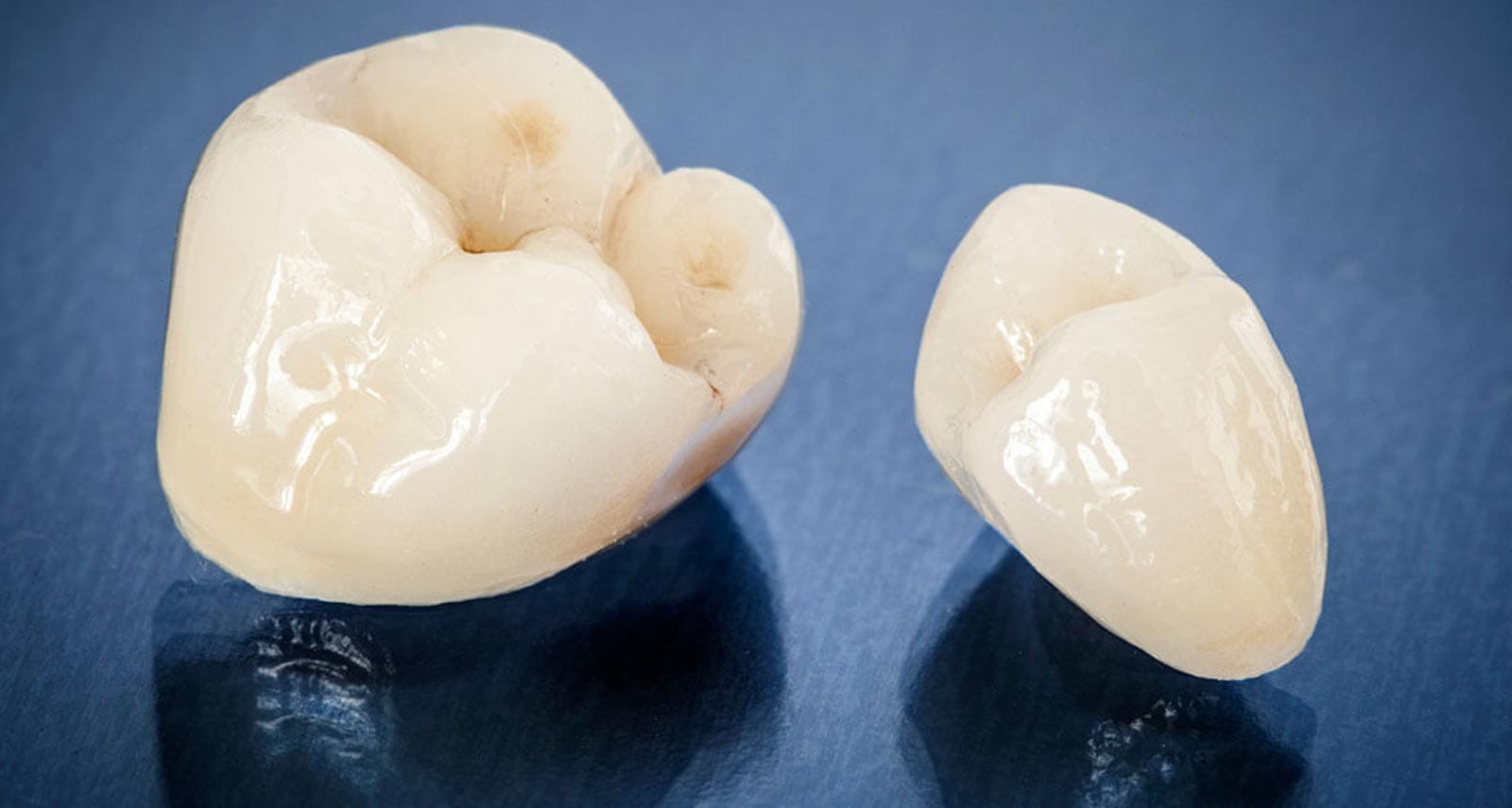 Tooth Caps