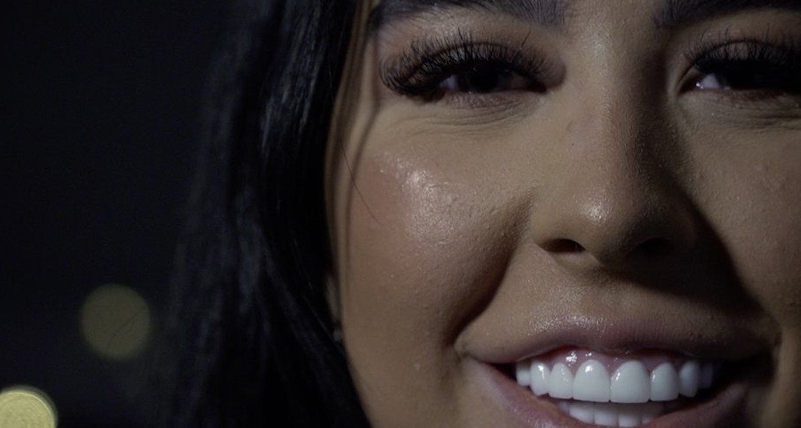 Turkey Teeth BBC Doc